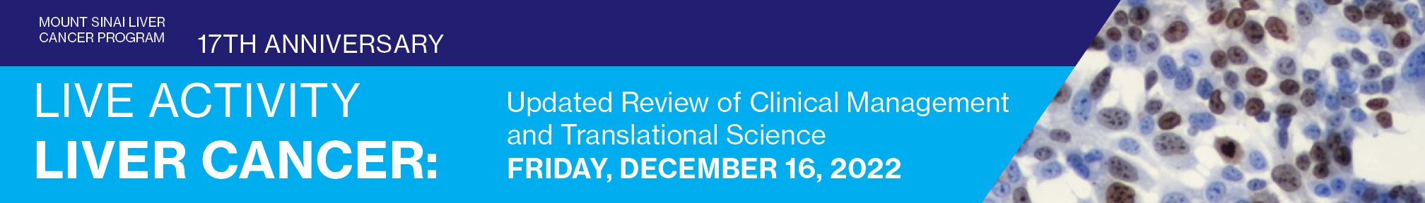 MOUNT SINAI LIVER CANCER PROGRAM. 17th ANNIVERSARY.  “LIVER CANCER: UPDATED REVIEW OF CLINICAL MANAGEMENT AND TRANSLATIONAL SCIENCE” Banner